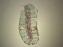 Pinus (den): mannelijke strobilus met groot aantal microsporofyllen en microsporangia.