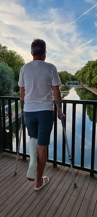 Man on crutches wearing white synthetic short leg cast