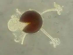 Cleistothecium van Microsphaera plantani