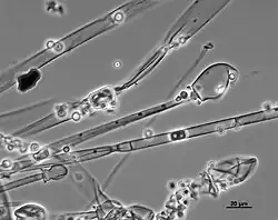 Mucor racemosus, een acidofiele schimmel.