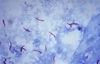 Mycobacterium