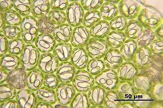 Echt vleugelmos (Nardia scalaris), bladcellen met chloroplasten tegen de celwand en met olielichaampjes, met hoekverdikkingen van celwanden