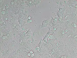 Neospora caninum