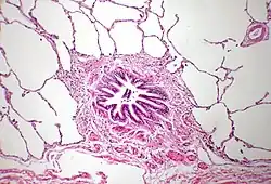 Coupe van het longweefsel. In het midden een bronchiole met daaromheen alveoli