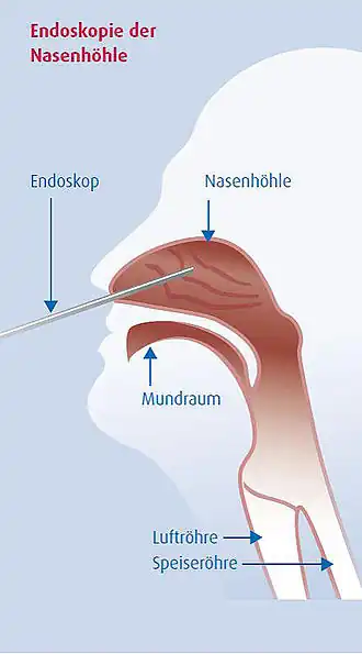 International Journal of Pediatric Otorhinolaryngology