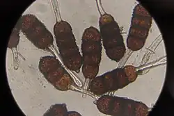 Teliosporen van veelcellige braamroest