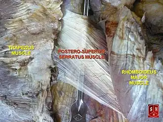 Musculus serratus posterior superior als dunne vliesachtige spier in het midden.