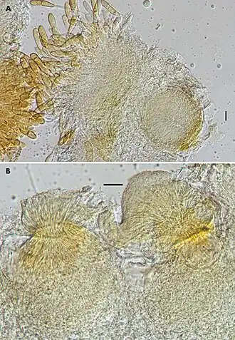 A Spermogonium met spermatiën en links een telium B Spermogonia met spermatiën. schaalstreep: 25 µm. Van Puccinia modiolae op Modiola caroliniana
