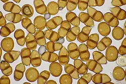 Teliosporen met enkele urediniosporen op bergbasterdwederik