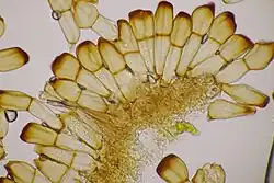 Teliosporen op rogge