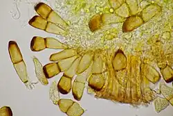 Teliosporen op gewone tarwe