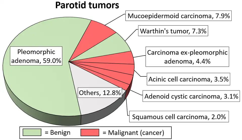 Relatief voorkomen van oorspeekselkliertumoren, waarbij adenoïdcystisch carcinoom relatief zeldzaam is.[13]
