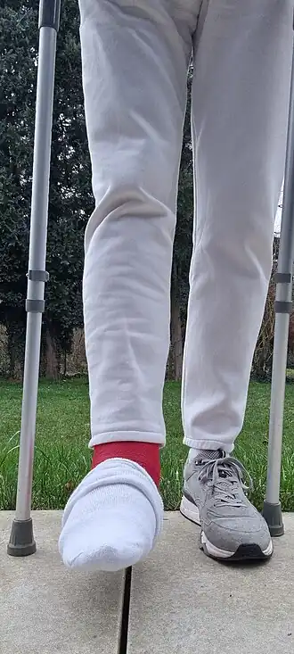 Man on crutches sporting red short leg cast with sock over the toes