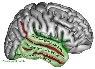 Gyrus temporalis medius aangegeven als 'middle temporal gyrus'.