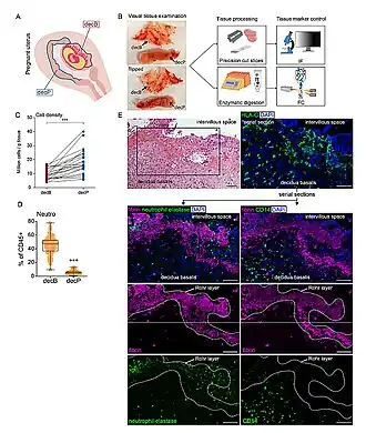 Eerste trimester decidua. E: met laag van Rohr met fibrine (magenta gekleurd)