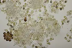 Uredinia en een telium op sleedoorn