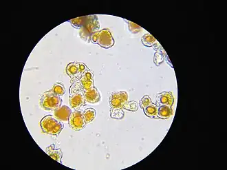 Trentepohlia umbrina