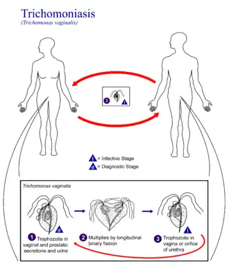 Trichomoniasis