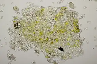 Conidia van Tuberculina sbrozzii en enkele aeciosporen