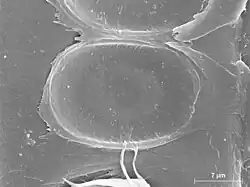 Torus in het kernhout van de fijnspar (Rasterelektronenmicroscopische opname)