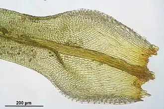 Ulota bruchii (knotskroesmos), gedeelte van blad met lange cellen in de bladbasis en korte cellen van de bladschijf