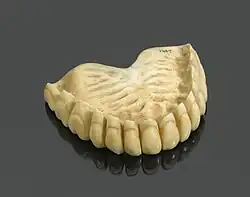 Ivoren vals gebit, 1780-1870