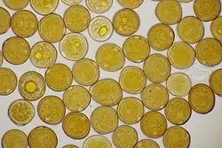 Urediniosporen op Armeria maritima subsp. elongata