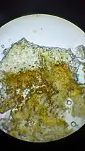 Uredinium