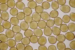 Urediniosporen met kiemporen van tuinboon-wikkeroest