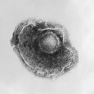 Varicellazostervirus