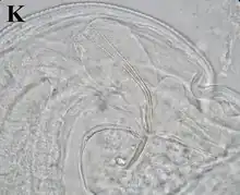 Het linkse spiculum in een mannelijke Pterygodermatites baiomydis.